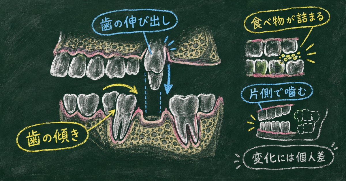奥歯を失ったまま放置すると、何が変わる？